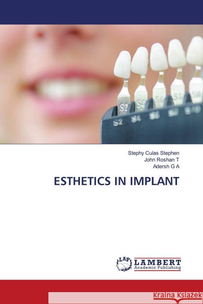 Esthetics in Implant Stephy Culas Stephen John Rosha Adersh G 9786206789260 LAP Lambert Academic Publishing