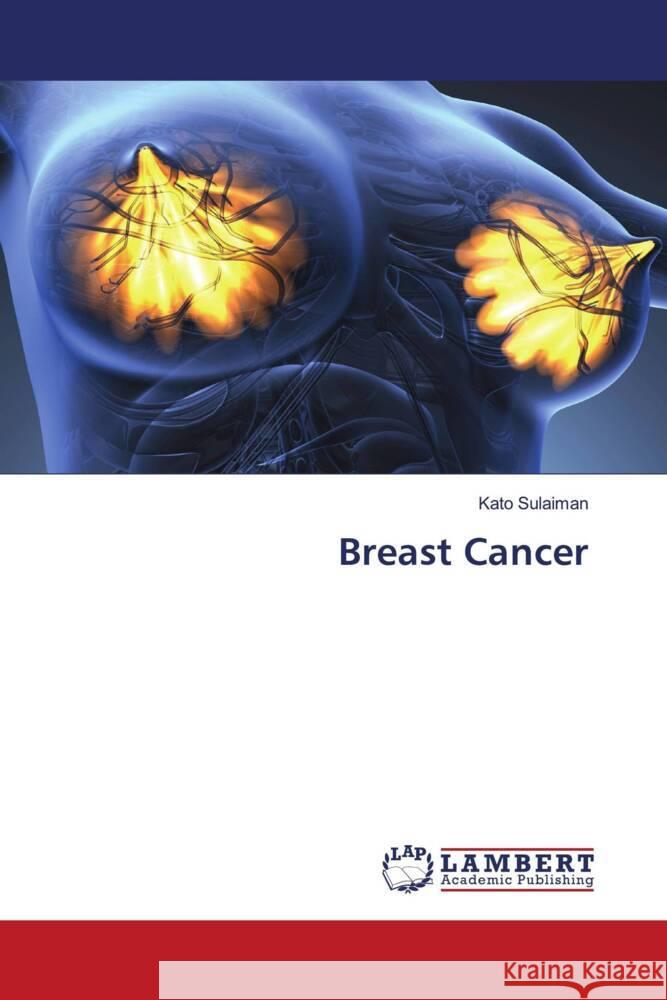 Breast Cancer Sulaiman, Kato 9786206790518