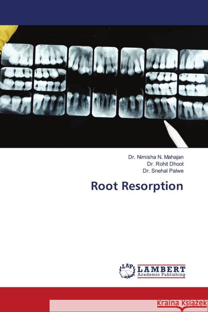 Root Resorption Mahajan, Dr. Nimisha N., Dhoot, Dr. Rohit, Palwe, Dr. Snehal 9786206790785 LAP Lambert Academic Publishing
