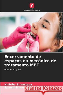 Encerramento de espaços na mecânica de tratamento MBT Srivastava, Nishtha, Srivastava, Sparsh 9786206807155