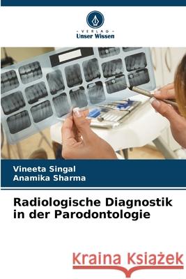 Radiologische Diagnostik in der Parodontologie Singal, Vineeta, Sharma, Anamika 9786206811756