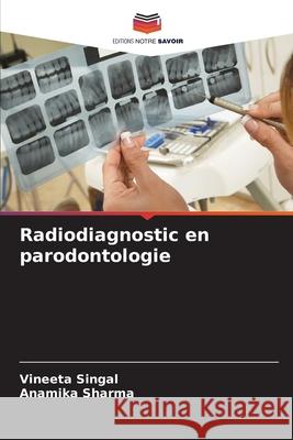Radiodiagnostic en parodontologie Singal, Vineeta, Sharma, Anamika 9786206811770