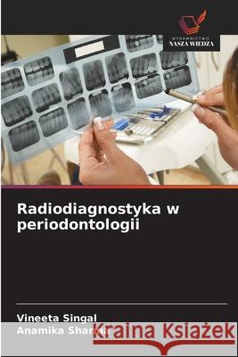 Radiodiagnostyka w periodontologii Singal, Vineeta, Sharma, Anamika 9786206811794