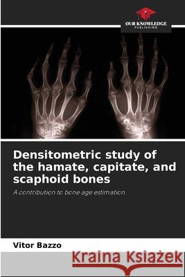 Densitometric study of the hamate, capitate, and scaphoid bones Bazzo, Vitor 9786206813453