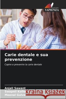 Carie dentale e sua prevenzione SAWANT, ANJALI, Kolhe, Swapnil, Gulve, Meenal 9786206825876