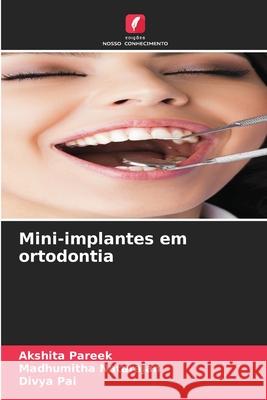 Mini-implantes em ortodontia Pareek, Akshita, Natarajan, Madhumitha, Pai, Divya 9786206826439