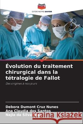 Évolution du traitement chirurgical dans la tétralogie de Fallot Dumont Cruz Nunes, Debora, dos Santos, Ana Cláudia, da Silva Braz, Najla 9786206826514