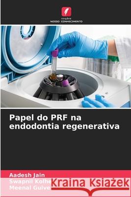 Papel do PRF na endodontia regenerativa JAIN, AADESH, Kolhe, Swapnil, Gulve, Meenal 9786206826736