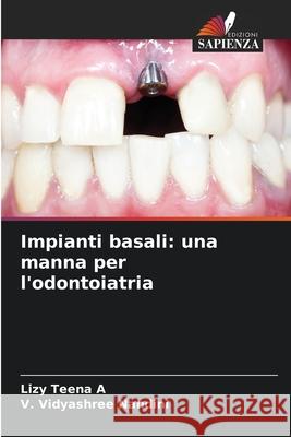 Impianti basali: una manna per l'odontoiatria A, Lizy Teena, Nandini, V. Vidyashree 9786206834694