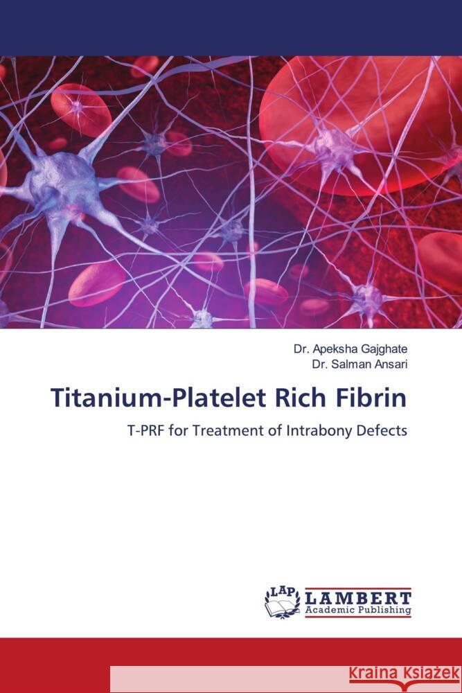 Titanium-Platelet Rich Fibrin Gajghate, Dr. Apeksha, Ansari, Dr. Salman 9786206843566