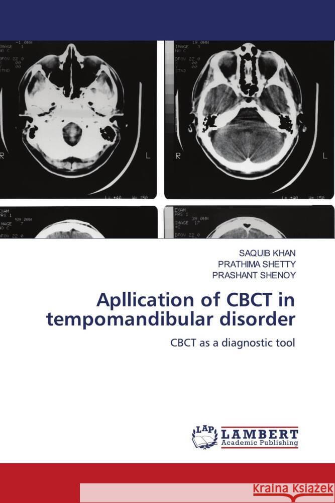 Apllication of CBCT in tempomandibular disorder KHAN, SAQUIB, Shetty, Prathima, SHENOY, PRASHANT 9786206844273