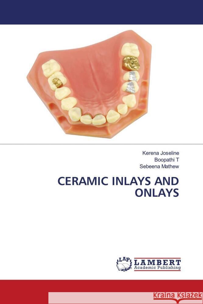 CERAMIC INLAYS AND ONLAYS Joseline, Kerena, T, Boopathi, Mathew, Sebeena 9786206846543