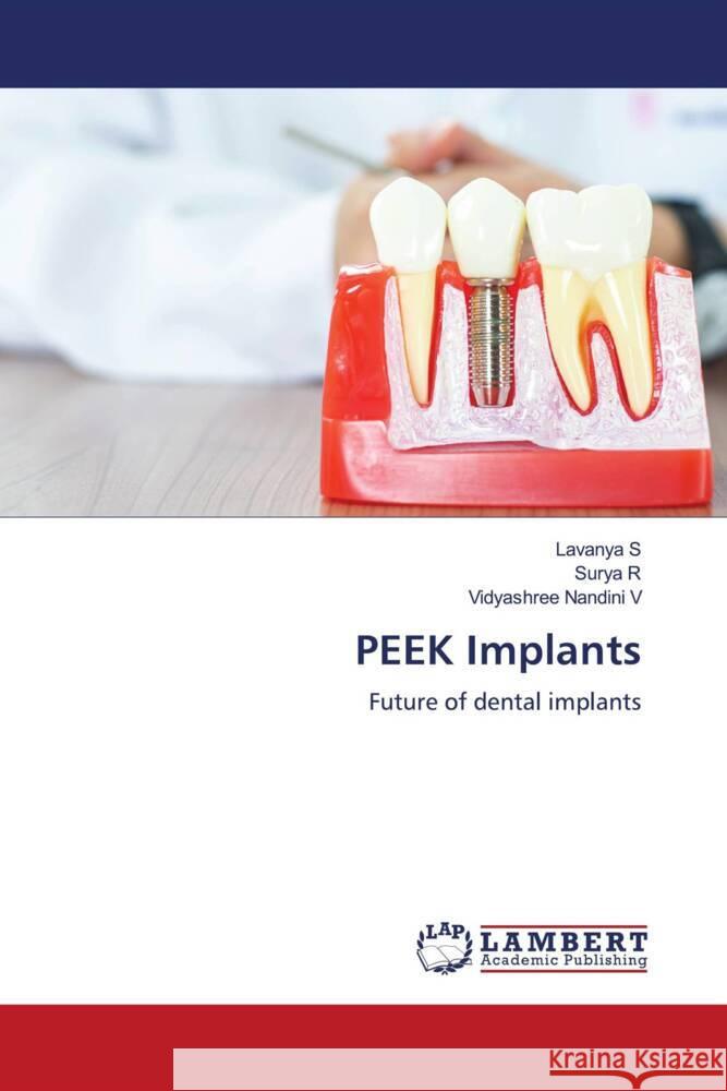 PEEK Implants S, Lavanya, R, Surya, Nandini V, Vidyashree 9786206846680