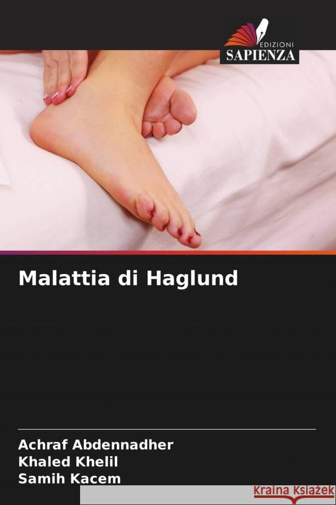 Malattia di Haglund Achraf Abdennadher Khaled Khelil Samih Kacem 9786206847083