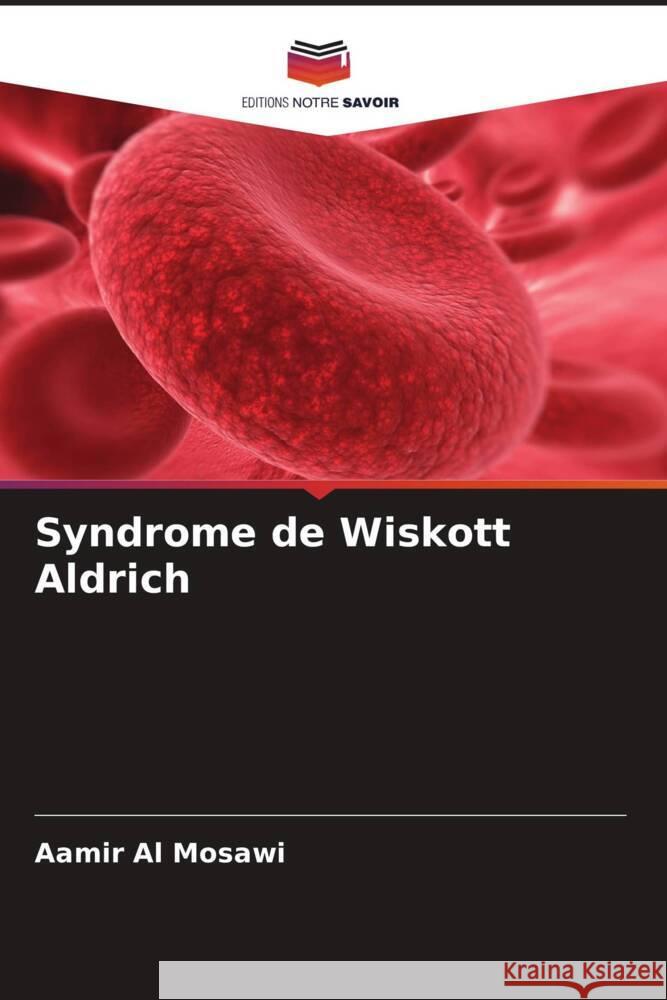 Syndrome de Wiskott Aldrich Aamir A 9786206847854 Editions Notre Savoir