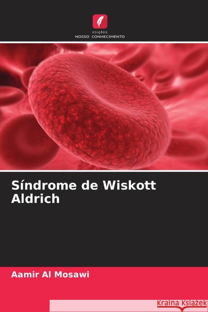 S?ndrome de Wiskott Aldrich Aamir A 9786206847878 Edicoes Nosso Conhecimento