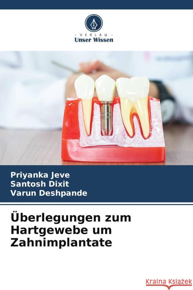 ?berlegungen zum Hartgewebe um Zahnimplantate Priyanka Jeve Santosh Dixit Varun Deshpande 9786206854142