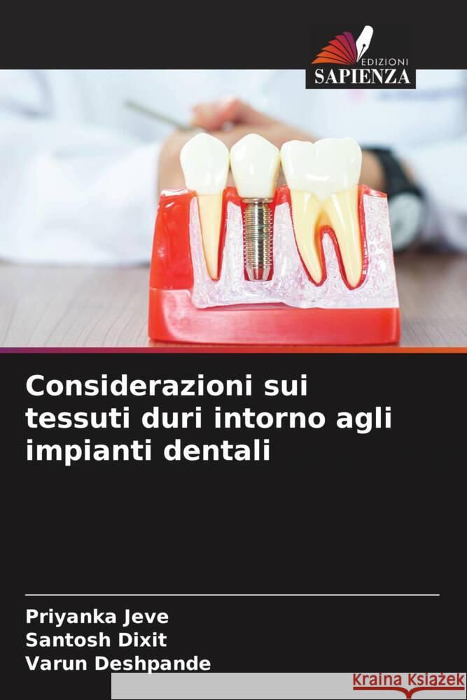 Considerazioni sui tessuti duri intorno agli impianti dentali Priyanka Jeve Santosh Dixit Varun Deshpande 9786206854197