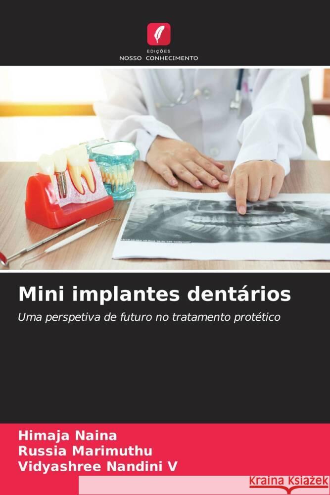 Mini implantes dent?rios Himaja Naina Russia Marimuthu Vidyashree Nandin 9786206859253
