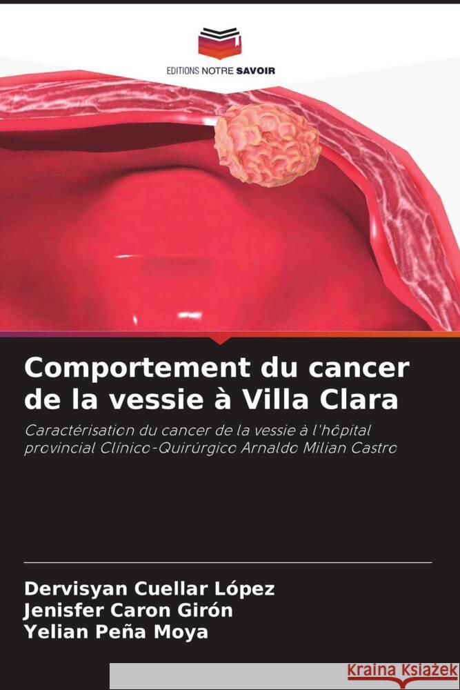 Comportement du cancer de la vessie ? Villa Clara Dervisyan Cuella Jenisfer Caro Yelian Pe? 9786206865186 Editions Notre Savoir