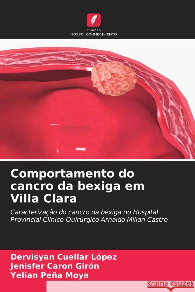 Comportamento do cancro da bexiga em Villa Clara Dervisyan Cuella Jenisfer Caro Yelian Pe? 9786206865193 Edicoes Nosso Conhecimento