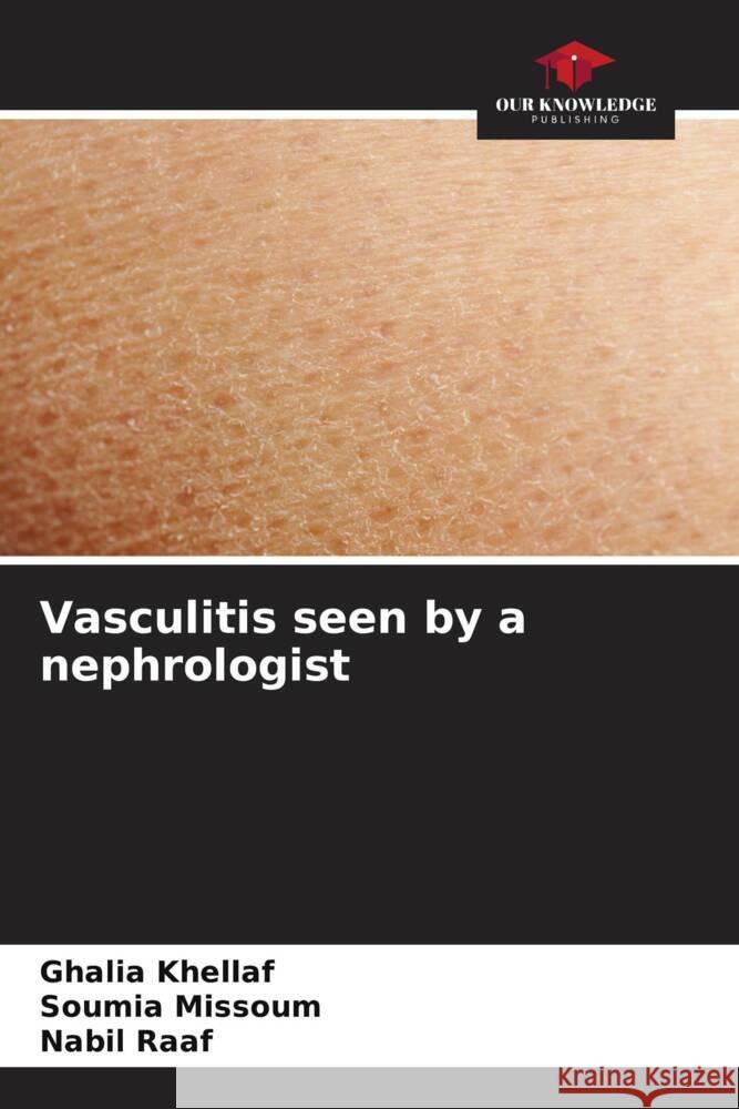 Vasculitis seen by a nephrologist Ghalia Khellaf Soumia Missoum Nabil Raaf 9786206869436