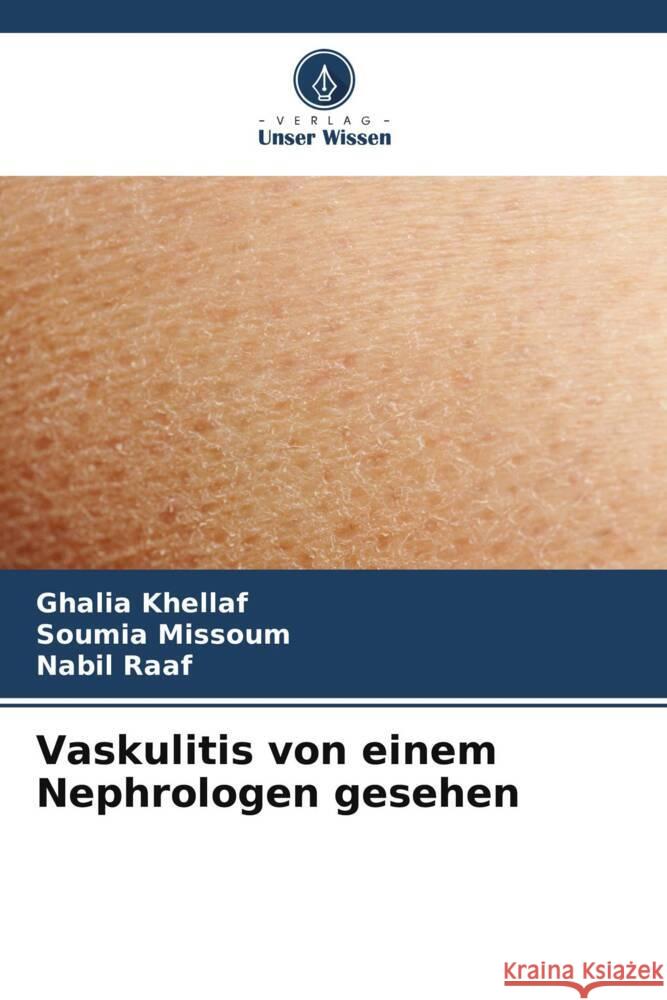 Vaskulitis von einem Nephrologen gesehen Ghalia Khellaf Soumia Missoum Nabil Raaf 9786206869443