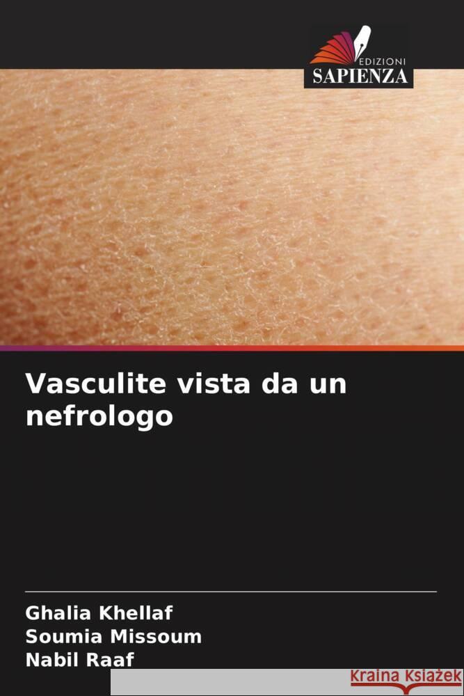 Vasculite vista da un nefrologo Ghalia Khellaf Soumia Missoum Nabil Raaf 9786206869467