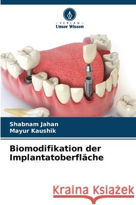 Biomodifikation der Implantatoberfläche Jahan, Shabnam, Kaushik, Mayur 9786206869818