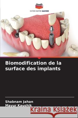 Biomodification de la surface des implants Jahan, Shabnam, Kaushik, Mayur 9786206869832