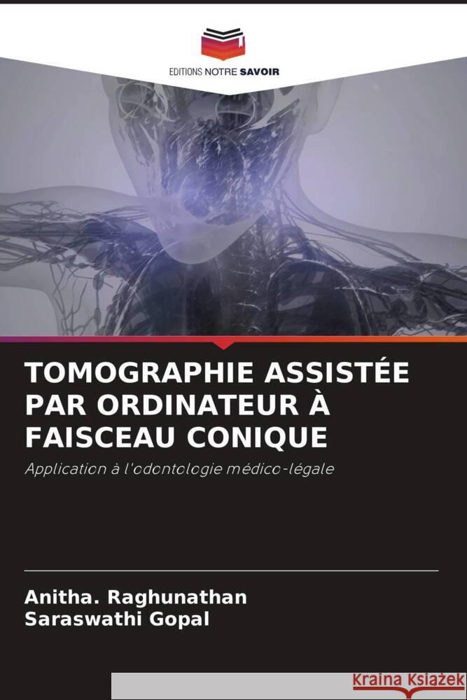 TOMOGRAPHIE ASSISTÉE PAR ORDINATEUR À FAISCEAU CONIQUE Raghunathan, Anitha., Gopal, Saraswathi 9786206870159