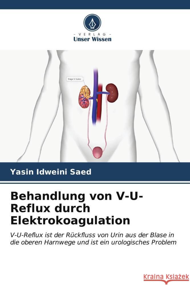 Behandlung von V-U-Reflux durch Elektrokoagulation Saed, Yasin Idweini 9786206879541