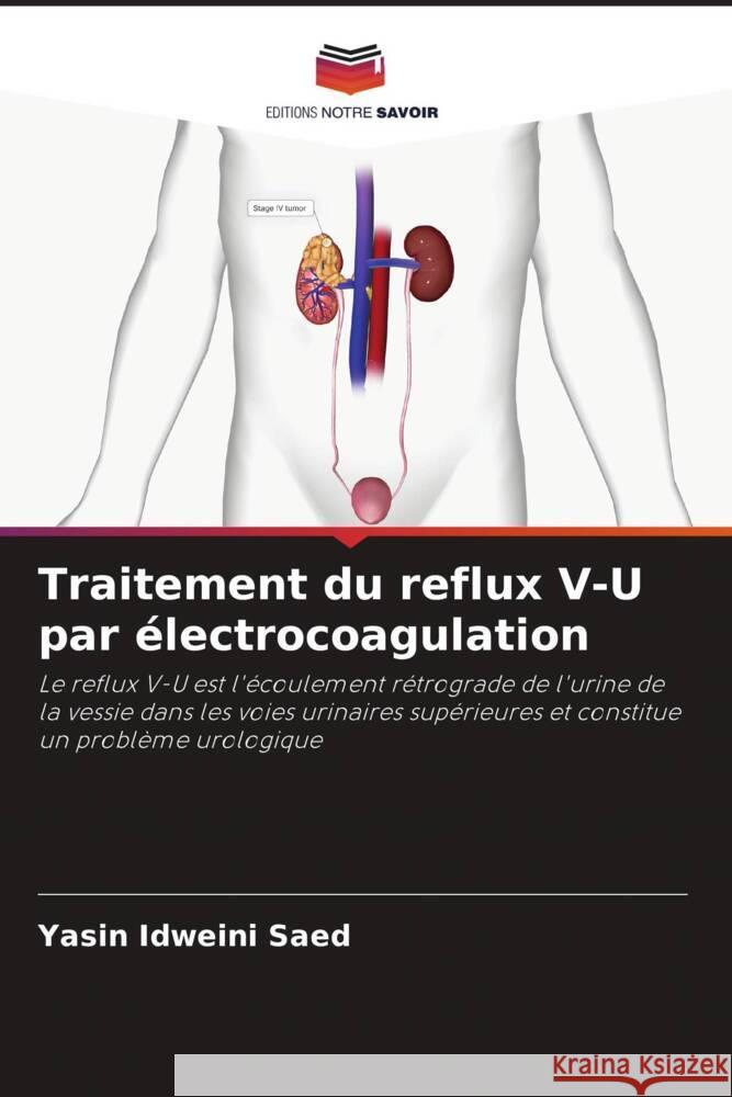 Traitement du reflux V-U par ?lectrocoagulation Yasin Idweini Saed 9786206879565