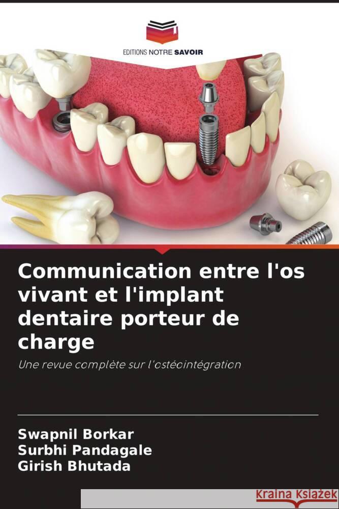 Communication entre l'os vivant et l'implant dentaire porteur de charge Swapnil Borkar Surbhi Pandagale Girish Bhutada 9786206884774