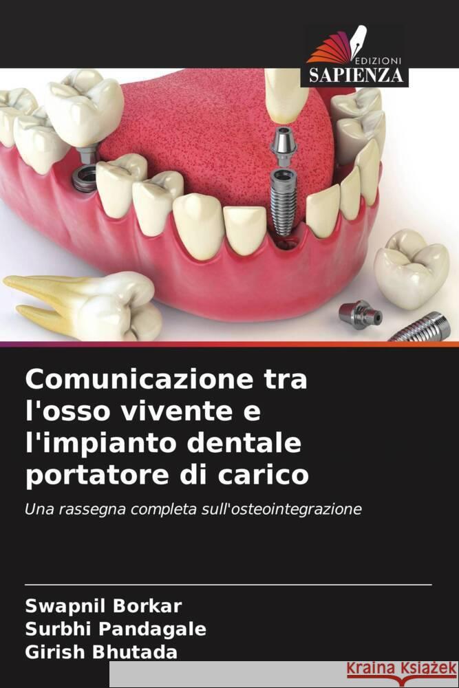 Comunicazione tra l'osso vivente e l'impianto dentale portatore di carico Swapnil Borkar Surbhi Pandagale Girish Bhutada 9786206884804