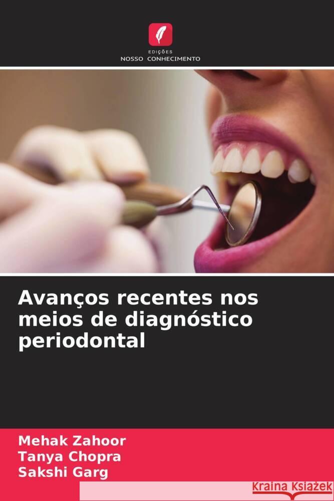 Avan?os recentes nos meios de diagn?stico periodontal Mehak Zahoor Tanya Chopra Sakshi Garg 9786206890607