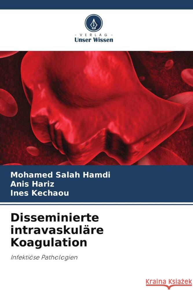 Disseminierte intravaskul?re Koagulation Mohamed Salah Hamdi Anis Hariz Ines Kechaou 9786206898313