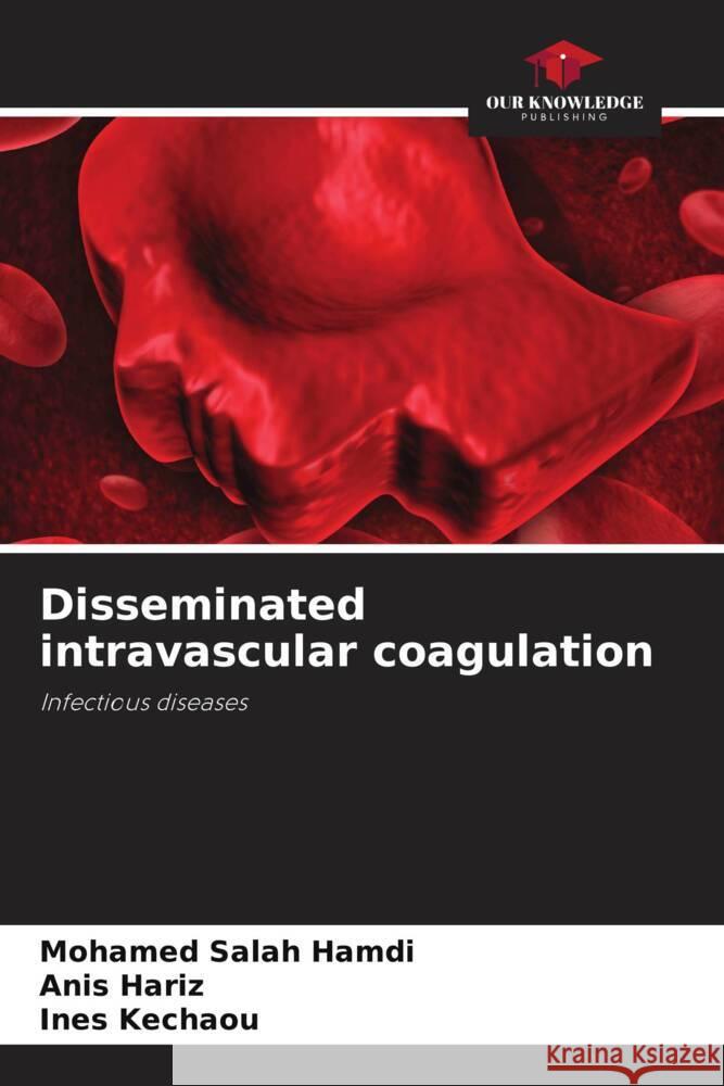 Disseminated intravascular coagulation Mohamed Salah Hamdi Anis Hariz Ines Kechaou 9786206898320