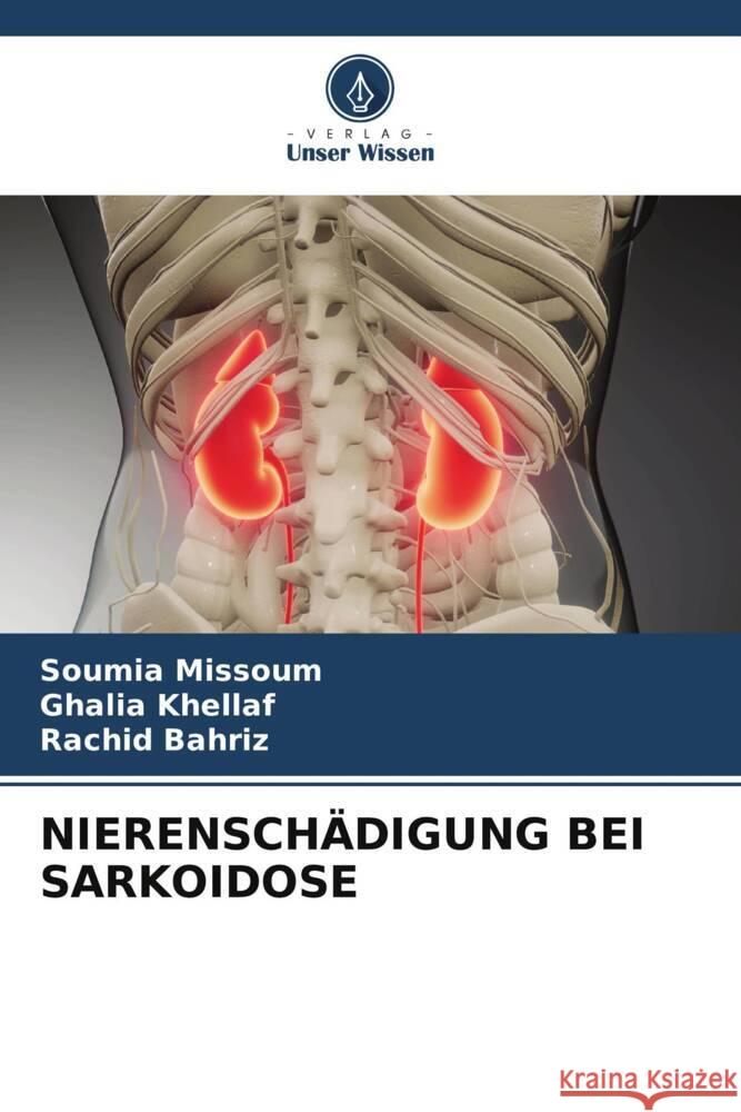 Nierensch?digung Bei Sarkoidose Soumia Missoum Ghalia Khellaf Rachid Bahriz 9786206901013