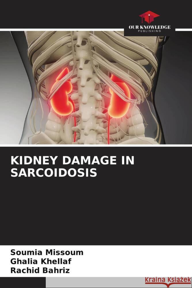 Kidney Damage in Sarcoidosis Soumia Missoum Ghalia Khellaf Rachid Bahriz 9786206901037