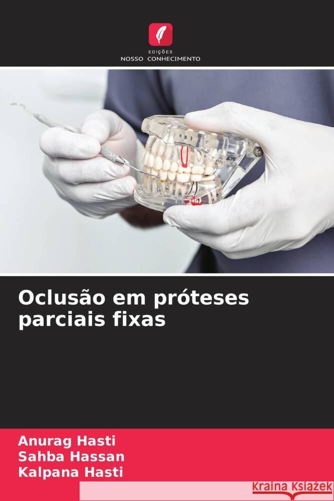 Oclusão em próteses parciais fixas Hasti, Anurag, Hassan, Sahba, Hasti, Kalpana 9786206905097