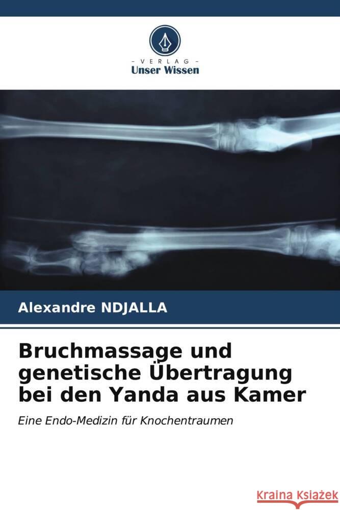 Bruchmassage und genetische ?bertragung bei den Yanda aus Kamer Alexandre Ndjalla 9786206907305 Verlag Unser Wissen