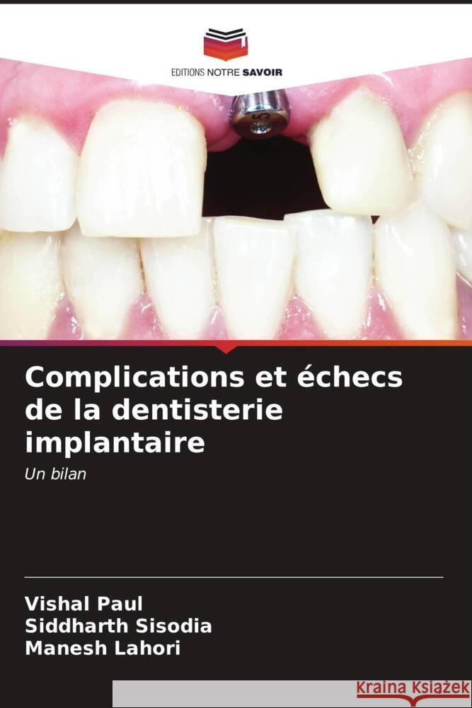 Complications et ?checs de la dentisterie implantaire Vishal Paul Siddharth Sisodia Manesh Lahori 9786206907381