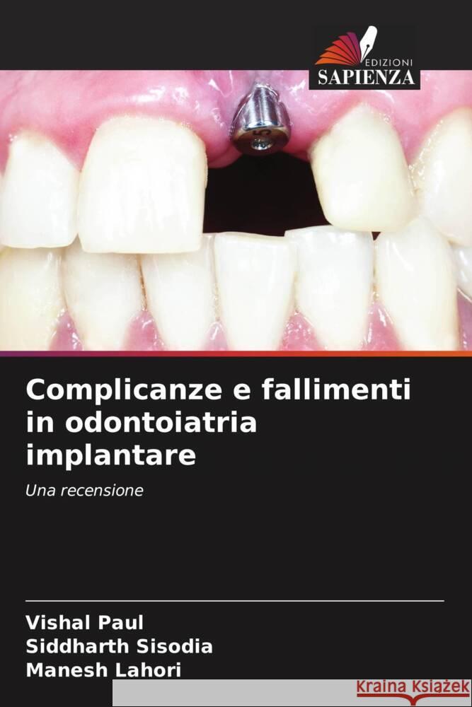 Complicanze e fallimenti in odontoiatria implantare Vishal Paul Siddharth Sisodia Manesh Lahori 9786206907398