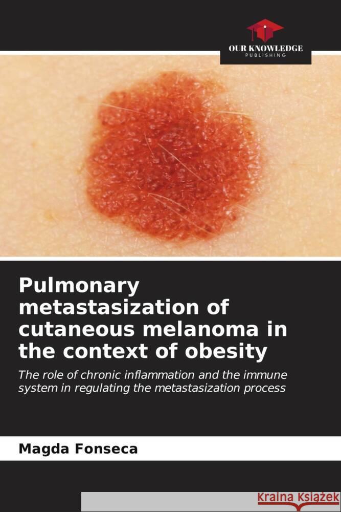 Pulmonary metastasization of cutaneous melanoma in the context of obesity Magda Fonseca 9786206909293