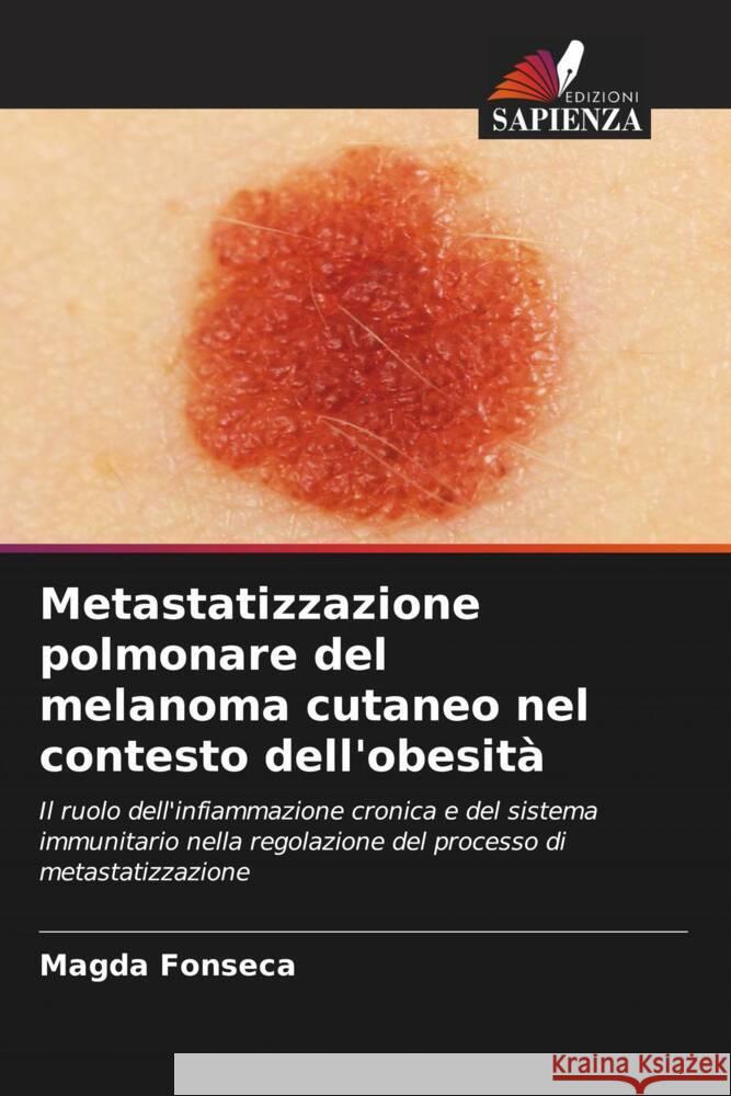 Metastatizzazione polmonare del melanoma cutaneo nel contesto dell'obesità Fonseca, Magda 9786206909347