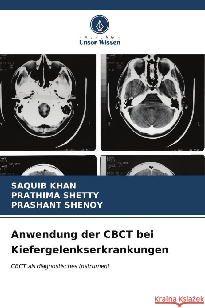 Anwendung der CBCT bei Kiefergelenkserkrankungen Saquib Khan Prathima Shetty Prashant Shenoy 9786206912644