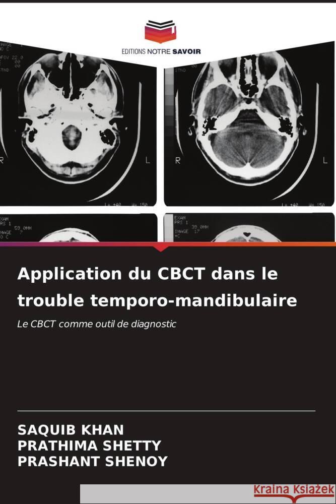 Application du CBCT dans le trouble temporo-mandibulaire Saquib Khan Prathima Shetty Prashant Shenoy 9786206912781