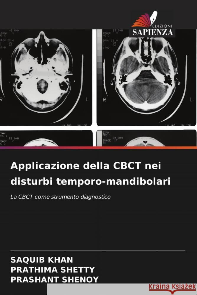 Applicazione della CBCT nei disturbi temporo-mandibolari Saquib Khan Prathima Shetty Prashant Shenoy 9786206912798