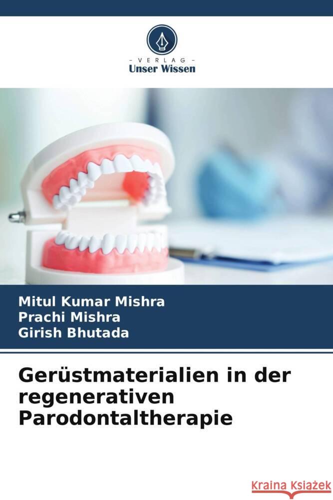 Gerüstmaterialien in der regenerativen Parodontaltherapie Mishra, Mitul Kumar, Mishra, Prachi, Bhutada, Girish 9786206925606